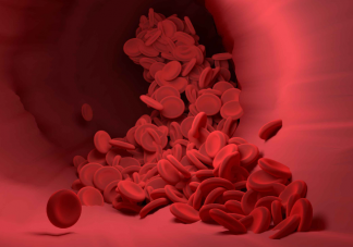 人类血栓中首次发现微塑料 血栓是如何形成的
