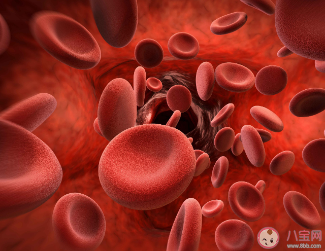 7个迹象发现致命血栓 什么环境下容易长血栓