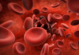 7个迹象发现致命血栓 什么环境下容易长血栓