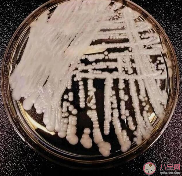 阿根廷首现超级真菌感染病例 超级真菌致死率高吗