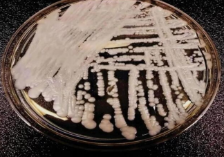 阿根廷首现超级真菌感染病例 超级真菌致死率高吗