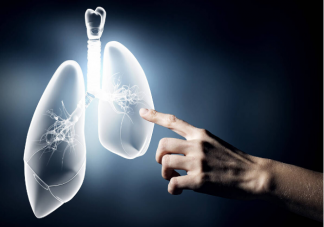 慢阻肺的高危因素有哪些 得了慢阻肺日常应该如何护理