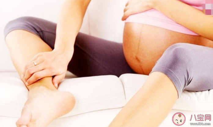 孕期生理性水肿需要治疗吗 如何判断水肿是否超出了正常指征