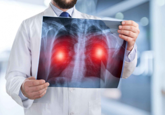 咳嗽出现这些症状要警惕肺炎 如何自我判断是否存在肺炎