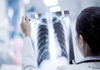 重症白肺死亡率40%以上是真的吗 如何预防白肺