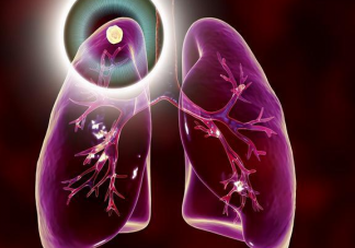 3个办法可提前预警白肺 白肺都会有哪些症状