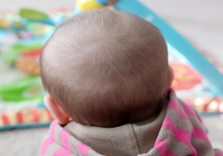 1岁多孩子经常掉头发是怎么回事 宝宝脱发会变成秃子吗