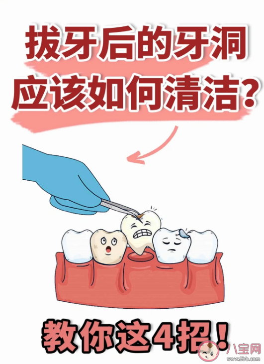拔完牙后千万不要清理牙缝 拔牙后口腔护理知识分享