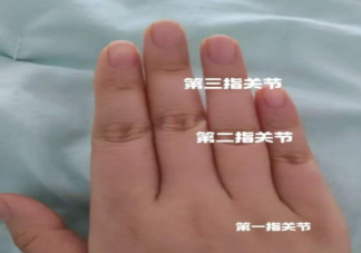 通过手指长短判断短指症靠谱吗 短指症需要手术治疗吗