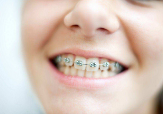 孩子要换完乳牙再整牙吗 必须整牙的4种情况