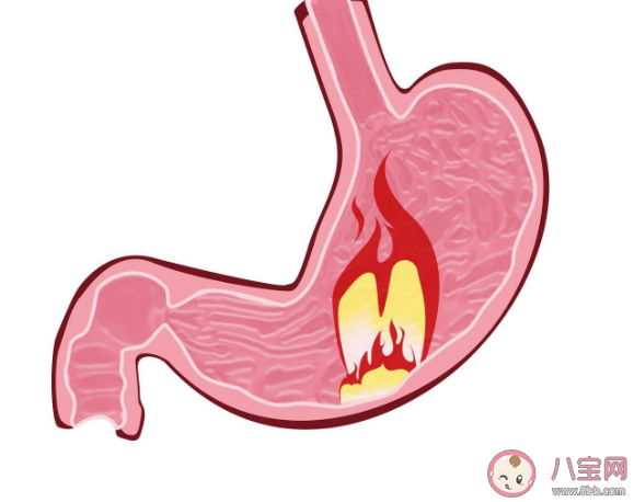 胃酸分泌过多容易引起什么疾病 经常反酸的人做好8件事