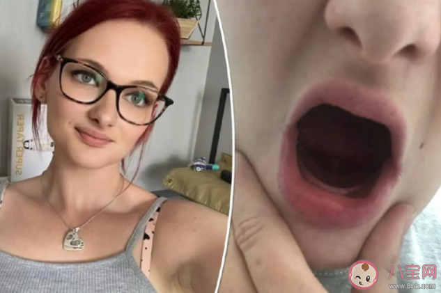 26岁女子生完孩子牙齿掉光是怎么回事 孕吐会导致掉牙吗