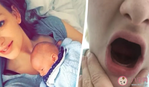 26岁女子生完孩子牙齿掉光是怎么回事 孕吐会导致掉牙吗