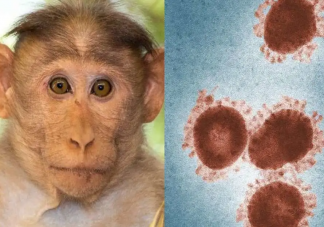 如何避免感染猴痘病毒 猴痘治疗的时间要多久