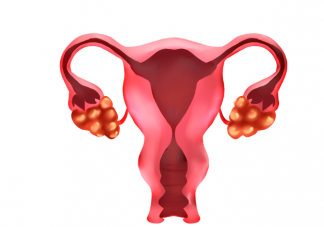 卵巢癌有什么特点 如何提高卵巢癌发现率