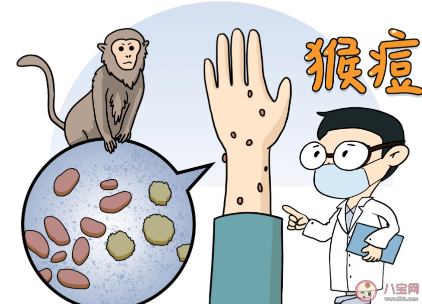 猴痘密接者需进行21天健康监测 猴痘感染了会有哪些症状