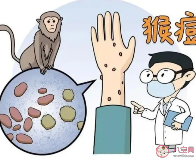 猴痘密接者需进行21天健康监测是怎么回事 确诊猴痘要隔离吗