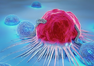 常见的7种癌前病变 得了癌症只能等死吗