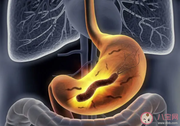 胃癌是如何吃出来的 哪些胃癌诱因易被我们忽视