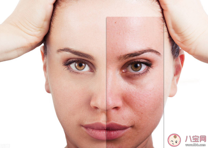 敏感期间能用护肤品吗 皮肤敏感怎么办