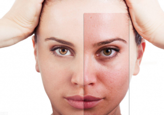 敏感期间能用护肤品吗 皮肤敏感怎么办