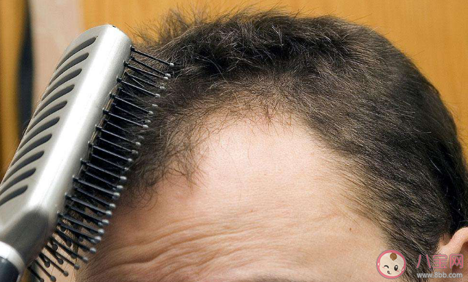 一到秋天脱发为什么更严重 频繁剃光头头发会更浓密吗