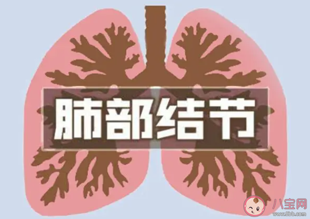 什么是肺结节 有肺结节会出现哪些症状