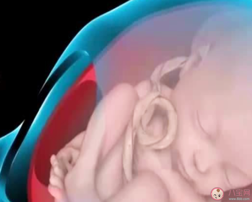胎儿脐带绕颈能顺产吗 胎儿脐带绕颈是什么原因
