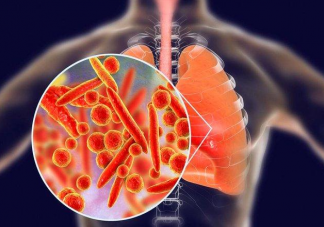 流感和支原体肺炎有哪些区别 支原体肺炎痊愈要多久
