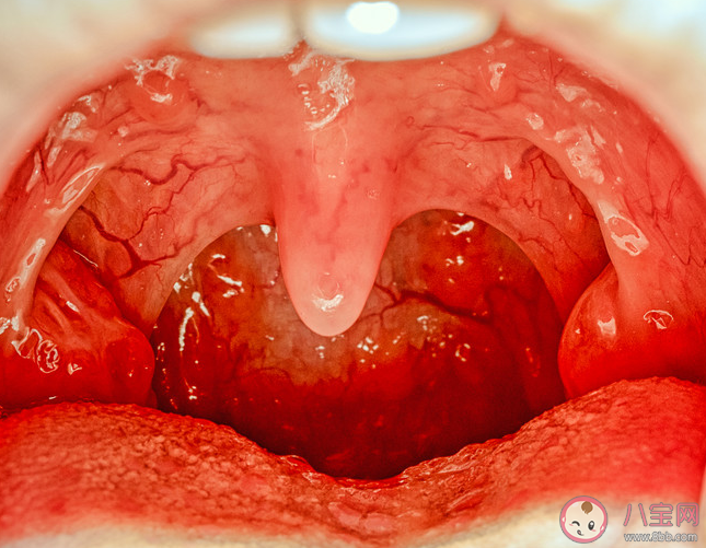 喉咙中间的小舌头有什么用 喉咙干痒该怎么办
