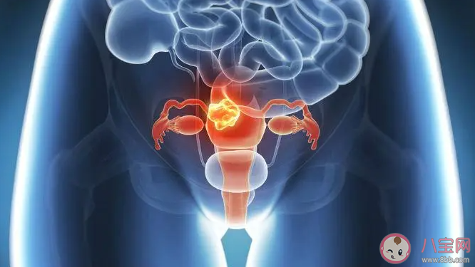 42岁断崖式衰老女子确诊卵巢早衰是真的吗 为什么会卵巢早衰