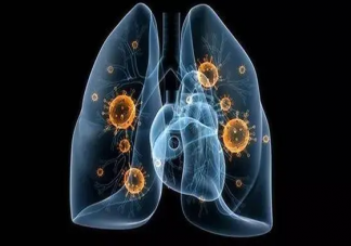 呼吸道感染什么情况要吃止咳药 呼吸道感染应该如何治疗