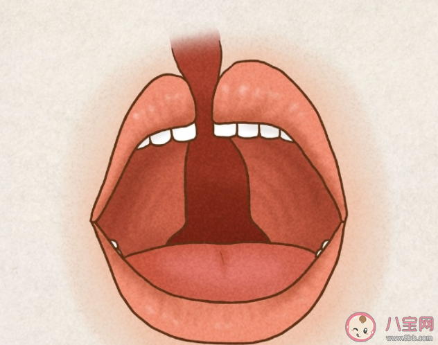 得了唇腭裂有什么影响 唇腭裂能被完全治愈吗